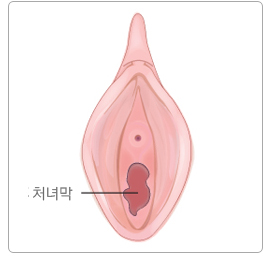 처녀막 위치